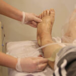 اوزون تراپی (Ozone Therapy) زخم: اکسیر اکسیژن برای التیام سریعتر در کلینیک زخم قم