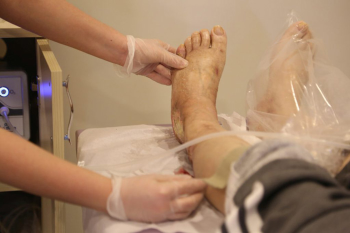 اوزون تراپی