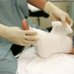 مراقبت تخصصی از زخمهای پا (مخصوص کلینیک زخم قم)